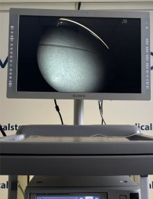 Медична відеосистема для колоно-гастроскопії FUJINON EPX-4450HD