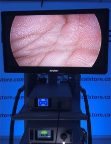 Медичний монітор Stryker 32